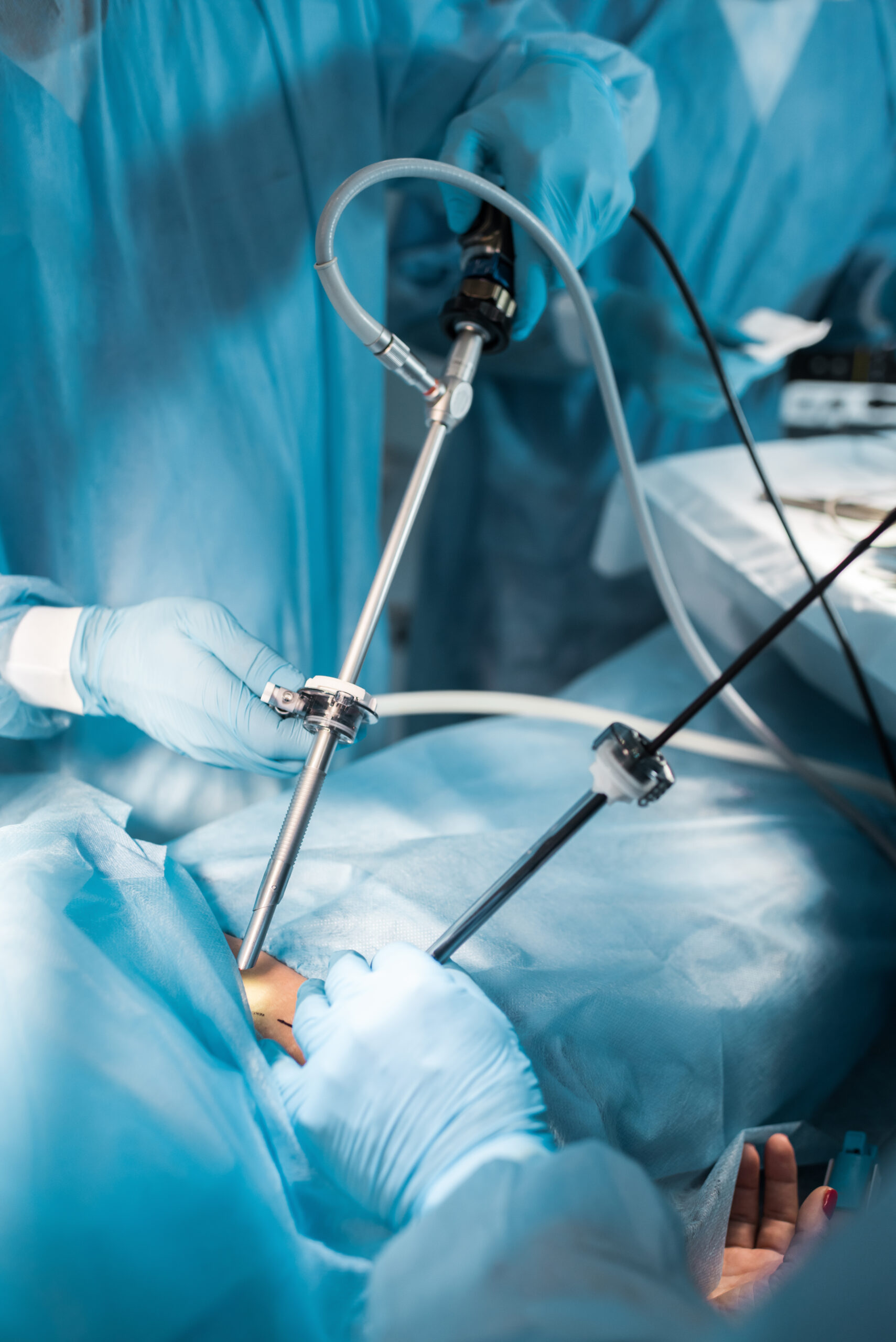 Laparoscopic surgery in progress in an operating room