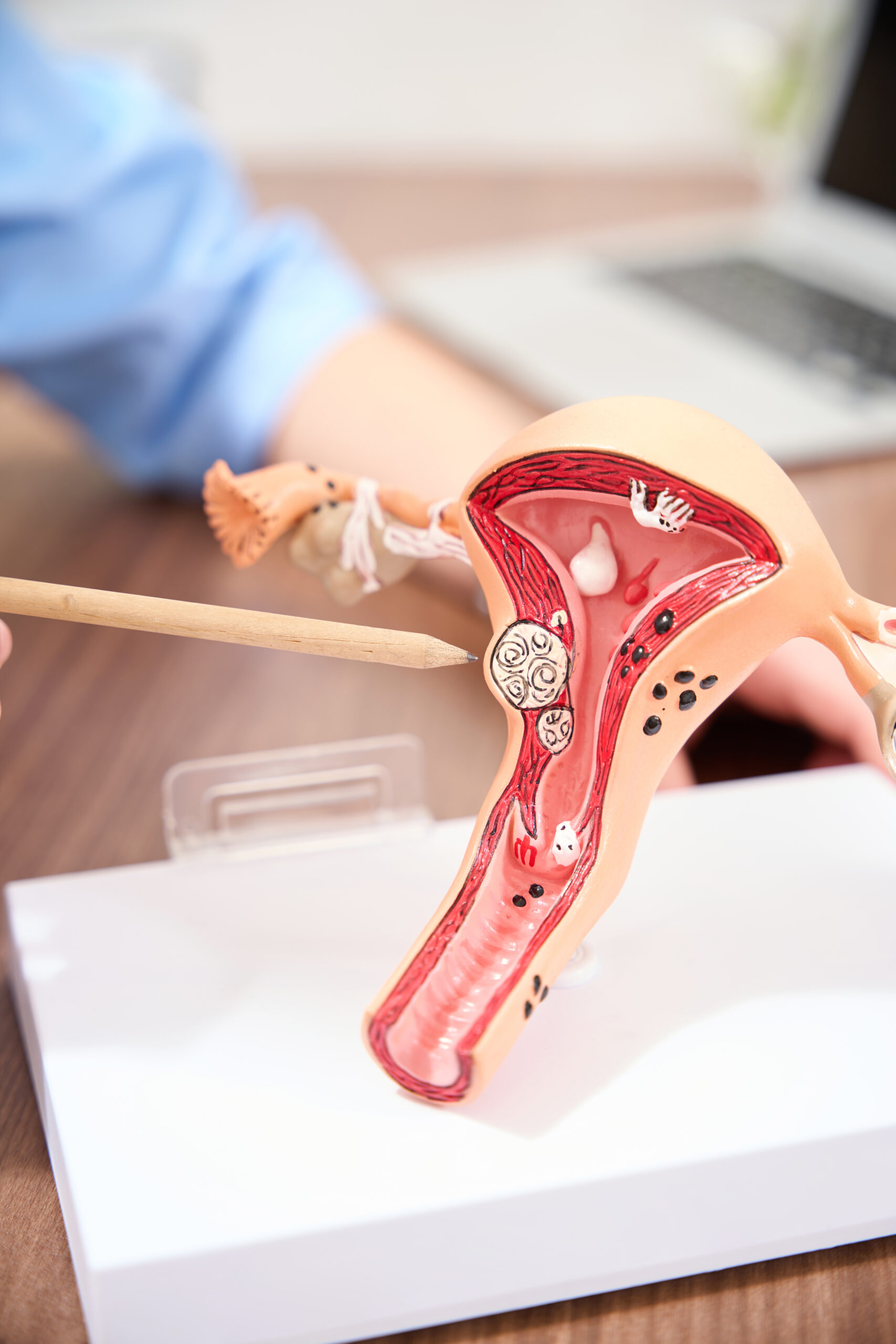 Medical professional explaining uterus anatomy to a patient