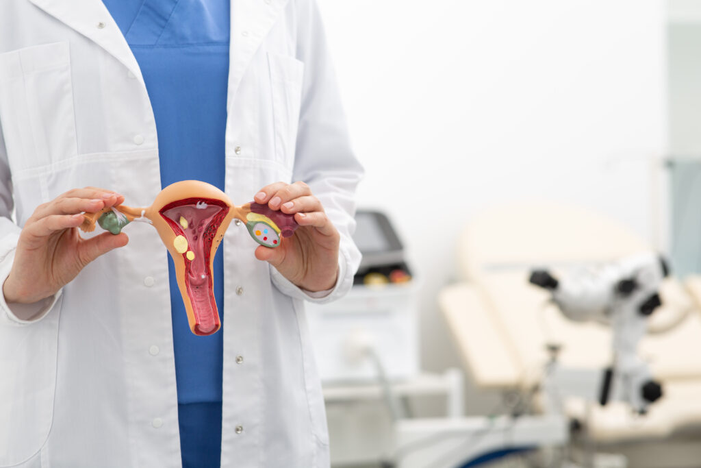 What Is an Intramural Fibroid and How Is It Treated?
